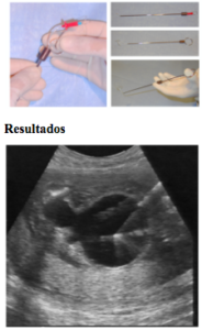 Uropatias obstrutivas