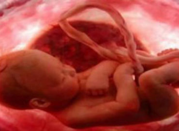 Medicina Fetal salva bebês no útero da mãe.