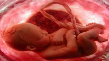 Medicina Fetal salva bebês no útero da mãe.