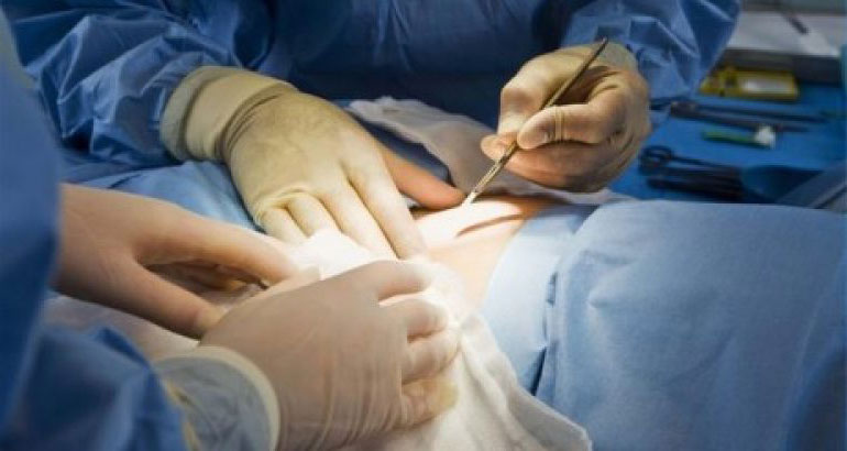 Complicações Maternas Decorrentes das Cirurgias Endoscópicas em Medicina Fetal